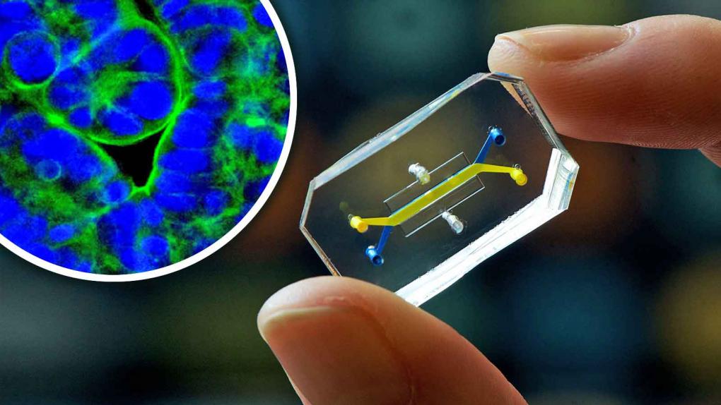 The Wyss Institute’s gut-on-a-chip constricts and relaxes, just as in the human body, producing finger-like projections called villi, shown here